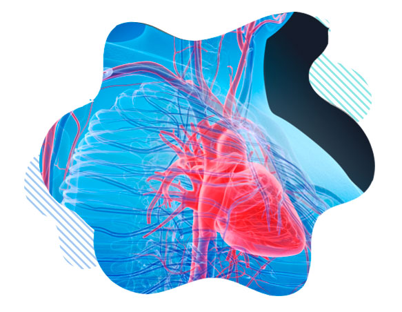 Cirurgia Vascular