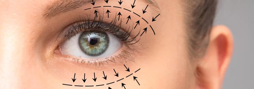 Blefaroplastia em Atibaia, Cirurgia das Pálpebras em Atibaia